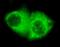 Keratin 7 antibody, STJ98484, St John