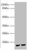 Mycobacterium tuberculosis Immunogenic protein MPT63  antibody, orb28319, Biorbyt, Western Blot image 