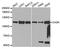 Calcium/Calmodulin Dependent Serine Protein Kinase antibody, A2501, ABclonal Technology, Western Blot image 