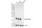 O-6-Methylguanine-DNA Methyltransferase antibody, 58121S, Cell Signaling Technology, Western Blot image 