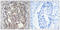 Cell Division Cycle 25A antibody, LS-C198775, Lifespan Biosciences, Immunohistochemistry paraffin image 