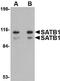 SATB Homeobox 1 antibody, ab70004, Abcam, Western Blot image 