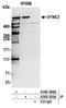 Spectrin Repeat Containing Nuclear Envelope Protein 2 antibody, A305-392A, Bethyl Labs, Immunoprecipitation image 