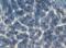 ATP Binding Cassette Subfamily B Member 1 antibody, M00049-1, Boster Biological Technology, Immunofluorescence image 
