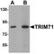 Tripartite Motif Containing 71 antibody, NBP1-76281, Novus Biologicals, Western Blot image 