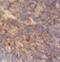 RAD51 Paralog D antibody, FNab07081, FineTest, Immunohistochemistry paraffin image 