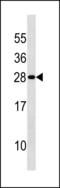 Density Regulated Re-Initiation And Release Factor antibody, LS-C203799, Lifespan Biosciences, Western Blot image 