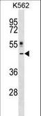 Cytokine Receptor Like Factor 1 antibody, LS-C167048, Lifespan Biosciences, Western Blot image 