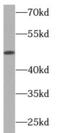 Endonuclease 8-like 1 antibody, FNab05648, FineTest, Western Blot image 