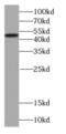 Serpin Family A Member 10 antibody, FNab07740, FineTest, Western Blot image 