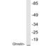 Ghrelin And Obestatin Prepropeptide antibody, LS-C292241, Lifespan Biosciences, Western Blot image 