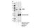 Deltex E3 Ubiquitin Ligase 3L antibody, 14795S, Cell Signaling Technology, Immunoprecipitation image 
