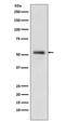 Phosphatase And Tensin Homolog antibody, M00006-1, Boster Biological Technology, Western Blot image 