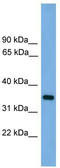 Serine protease 3 antibody, TA342157, Origene, Western Blot image 