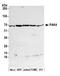 Serine/threonine-protein kinase PAK 4 antibody, A300-356A, Bethyl Labs, Western Blot image 