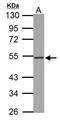 Thymidine Phosphorylase antibody, GTX100892, GeneTex, Western Blot image 