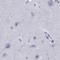 Serpin Family A Member 3 antibody, NBP1-90295, Novus Biologicals, Immunohistochemistry paraffin image 