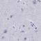Serpin Family A Member 3 antibody, NBP1-90295, Novus Biologicals, Immunohistochemistry paraffin image 