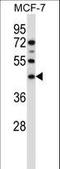 Sphingomyelin Synthase 1 antibody, LS-C169044, Lifespan Biosciences, Western Blot image 