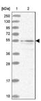 Spermatogenesis Associated 16 antibody, NBP2-13368, Novus Biologicals, Western Blot image 