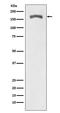 Platelet Derived Growth Factor Receptor Beta antibody, P00096, Boster Biological Technology, Western Blot image 