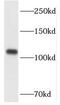 Hepatocyte Growth Factor-Regulated Tyrosine Kinase Substrate antibody, FNab03853, FineTest, Western Blot image 
