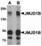 Lysine Demethylase 3B antibody, orb94314, Biorbyt, Western Blot image 