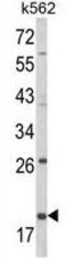 KLRD1 antibody, GTX81129, GeneTex, Western Blot image 