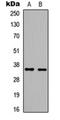 High Mobility Group 20B antibody, orb256604, Biorbyt, Western Blot image 