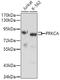 Protein Kinase C Alpha antibody, 13-116, ProSci, Western Blot image 