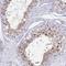 Galactosidase Beta 1 Like antibody, NBP1-81235, Novus Biologicals, Immunofluorescence image 