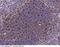CDw40 antibody, 102296-T10, Sino Biological, Immunohistochemistry frozen image 