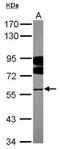 Far Upstream Element Binding Protein 3 antibody, GTX115168, GeneTex, Western Blot image 