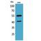 Interleukin 2 Receptor Subunit Gamma antibody, LS-C387138, Lifespan Biosciences, Western Blot image 