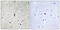 3-Phosphoinositide Dependent Protein Kinase 1 antibody, abx012583, Abbexa, Immunohistochemistry paraffin image 