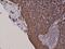 Keratin 5 antibody, M00398-3, Boster Biological Technology, Immunohistochemistry paraffin image 