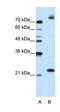 Frizzled Class Receptor 9 antibody, orb330167, Biorbyt, Western Blot image 