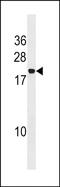 Peptidylprolyl Isomerase A Like 4A antibody, PA5-49103, Invitrogen Antibodies, Western Blot image 