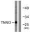 Troponin I3, Cardiac Type antibody, A01720-1, Boster Biological Technology, Western Blot image 