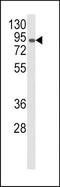 Amine Oxidase Copper Containing 3 antibody, TA325044, Origene, Western Blot image 