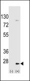 Ubiquitin Conjugating Enzyme E2 H antibody, 61-084, ProSci, Western Blot image 