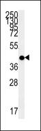 Melanocortin 2 Receptor antibody, MBS9200722, MyBioSource, Western Blot image 