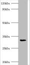 Ribosomal Protein SA antibody, A55158-100, Epigentek, Western Blot image 