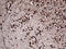 Orthodenticle Homeobox 2 antibody, LS-C794972, Lifespan Biosciences, Immunohistochemistry paraffin image 