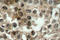 Forkhead Box O3 antibody, LS-C177630, Lifespan Biosciences, Immunohistochemistry paraffin image 