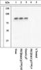 Protein Kinase C Beta antibody, GTX25817, GeneTex, Western Blot image 