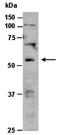 STEAP3 Metalloreductase antibody, orb66804, Biorbyt, Western Blot image 