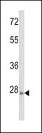 Rho Family GTPase 3 antibody, 63-181, ProSci, Western Blot image 