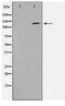 Activity Dependent Neuroprotector Homeobox antibody, TA347586, Origene, Western Blot image 