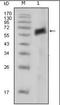 AXL Receptor Tyrosine Kinase antibody, orb95121, Biorbyt, Western Blot image 